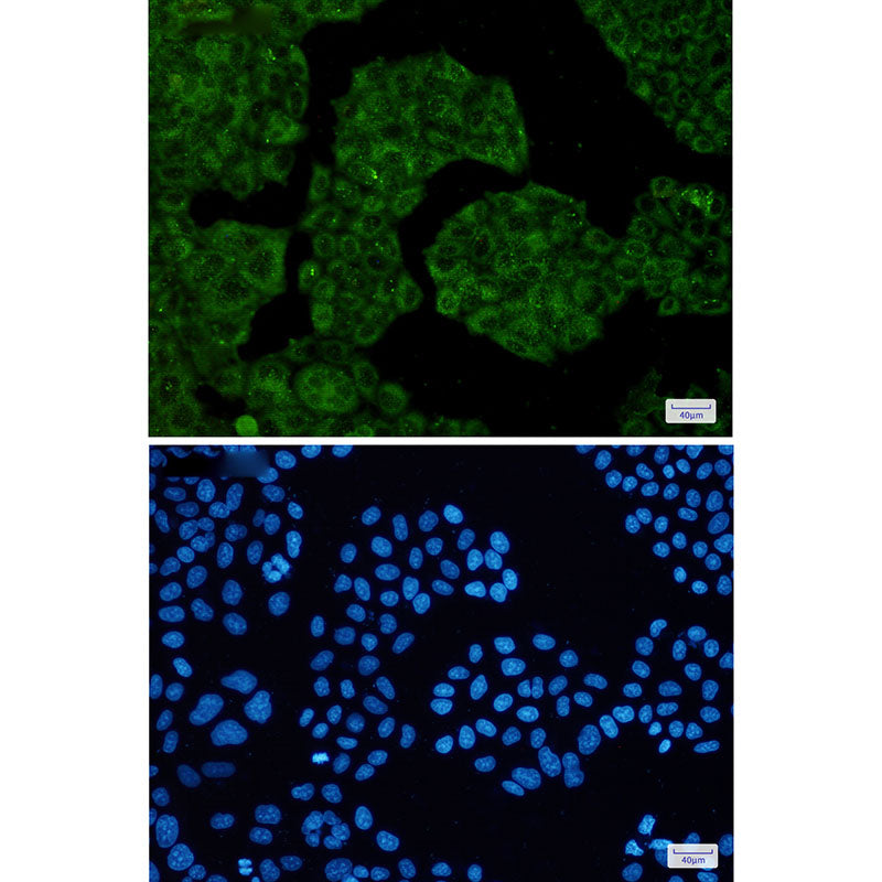 Anti-NUDT9 Rabbit Monoclonal Antibody