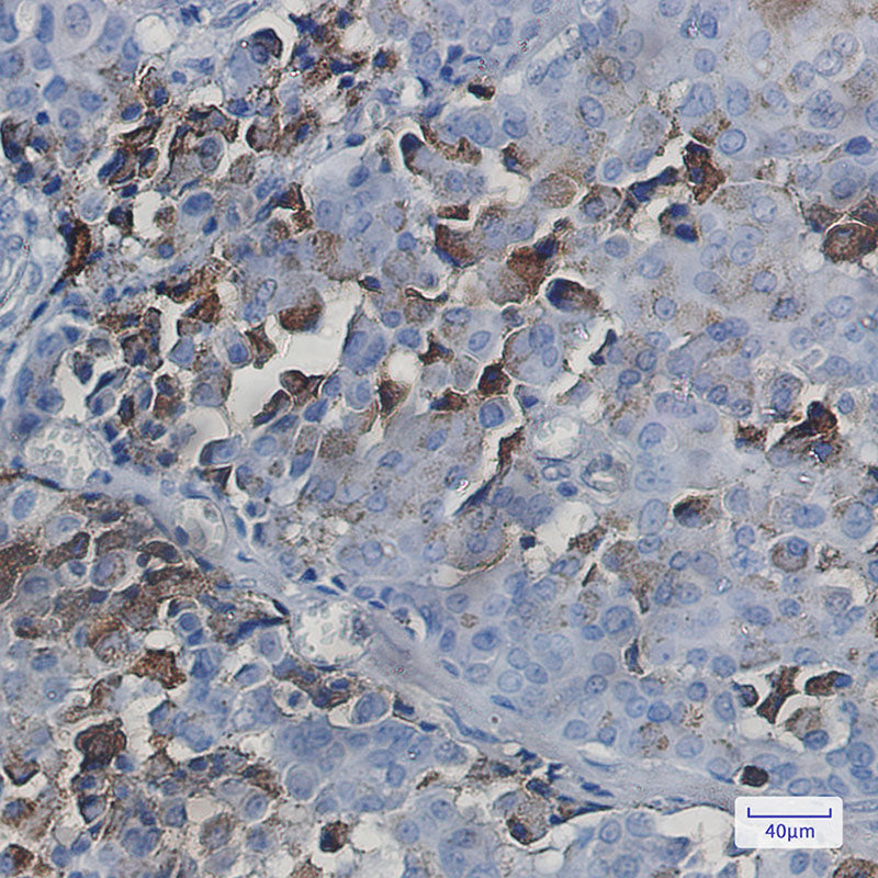 Anti-NXF1 Rabbit Monoclonal Antibody