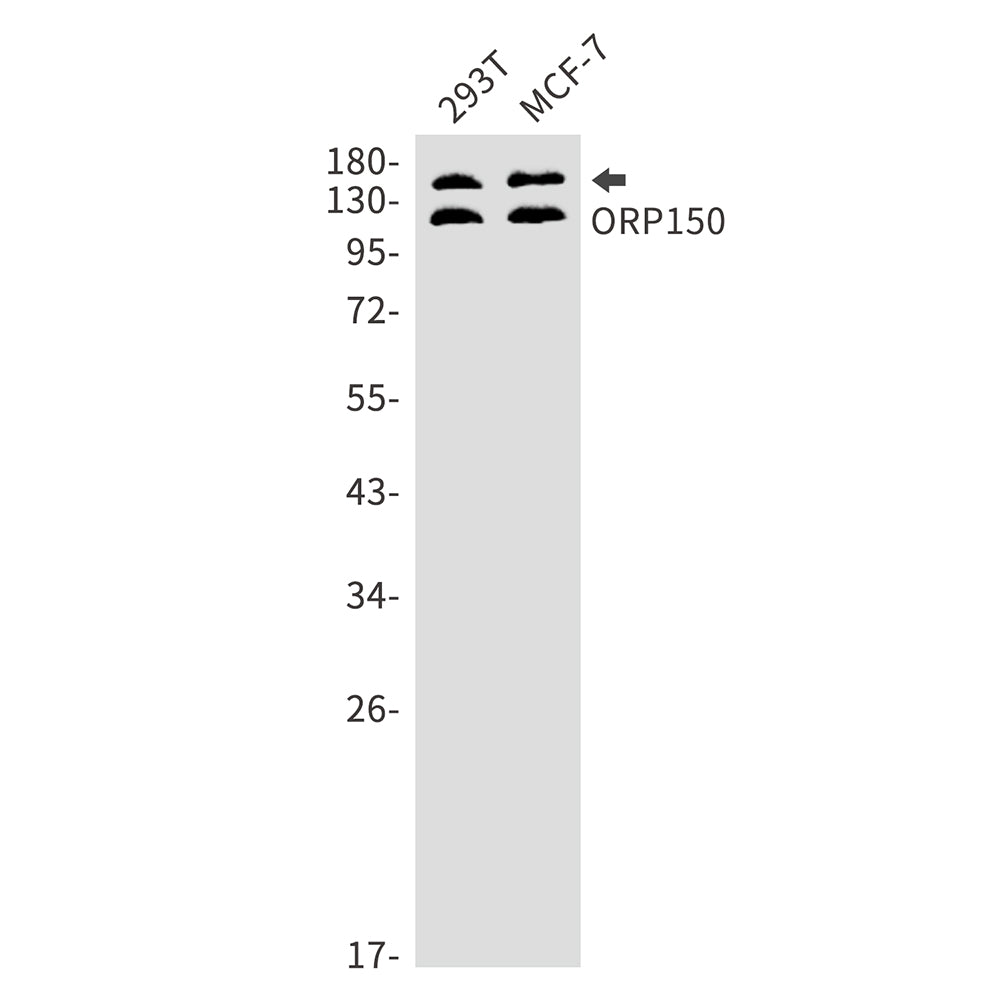 Anti-ORP150 Rabbit Monoclonal Antibody