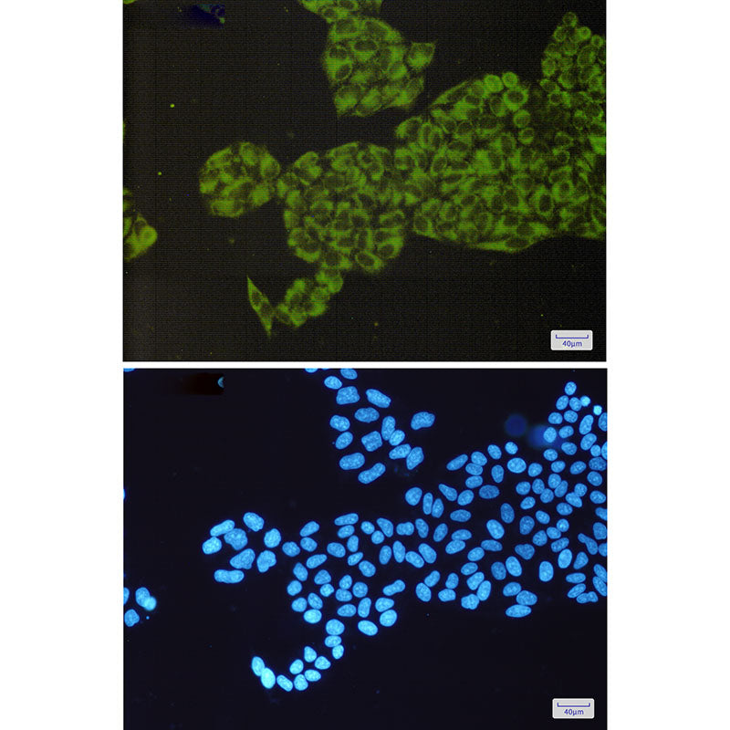 Anti-ORP150 Rabbit Monoclonal Antibody