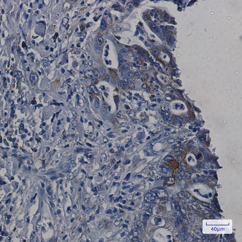 Anti-ORP150 Rabbit Monoclonal Antibody