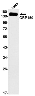 Anti-ORP150 Rabbit Monoclonal Antibody