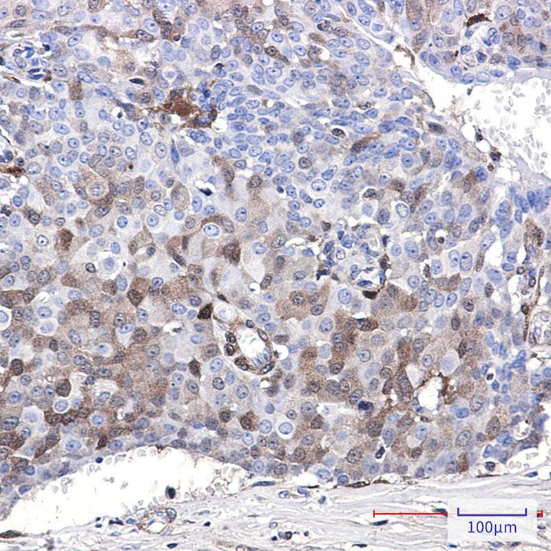 Anti-CDKN2C Rabbit Monoclonal Antibody