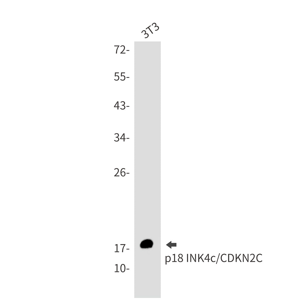 Anti-CDKN2C Rabbit Monoclonal Antibody