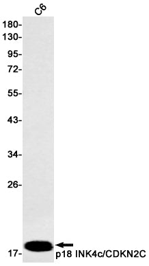 Anti-CDKN2C Rabbit Monoclonal Antibody