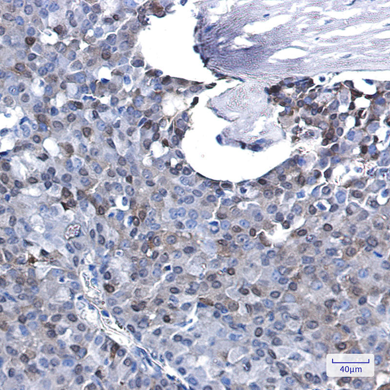 Anti-p27 Kip 1 Rabbit Monoclonal Antibody