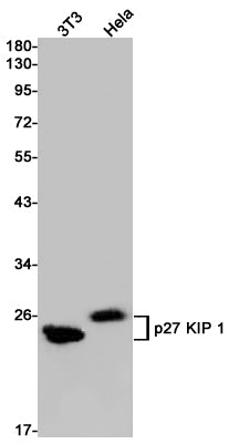 Anti-p27 Kip 1 Rabbit Monoclonal Antibody