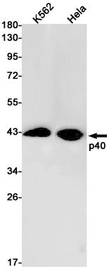 Anti-p40 Rabbit Monoclonal Antibody