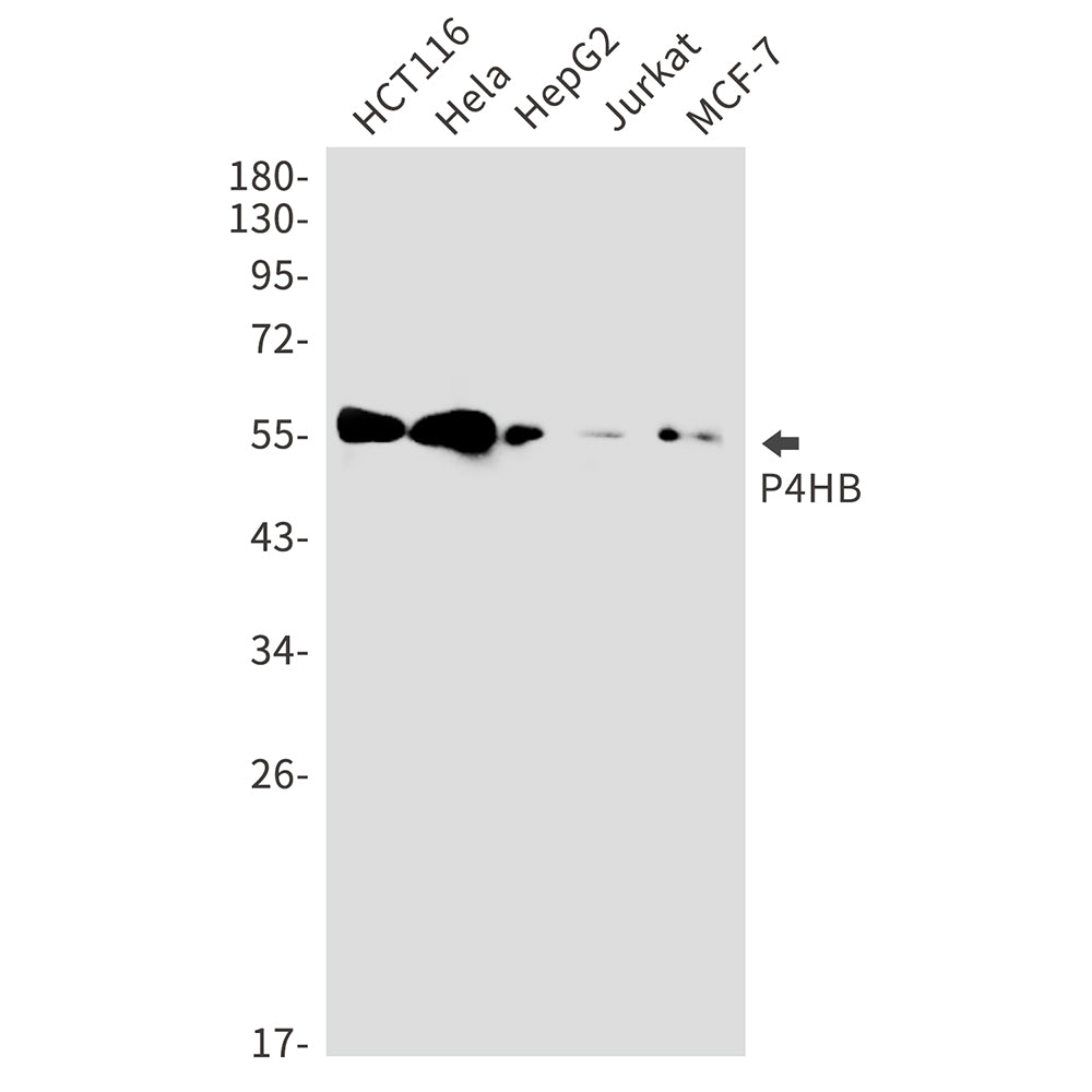Anti-P4HB Rabbit Monoclonal Antibody