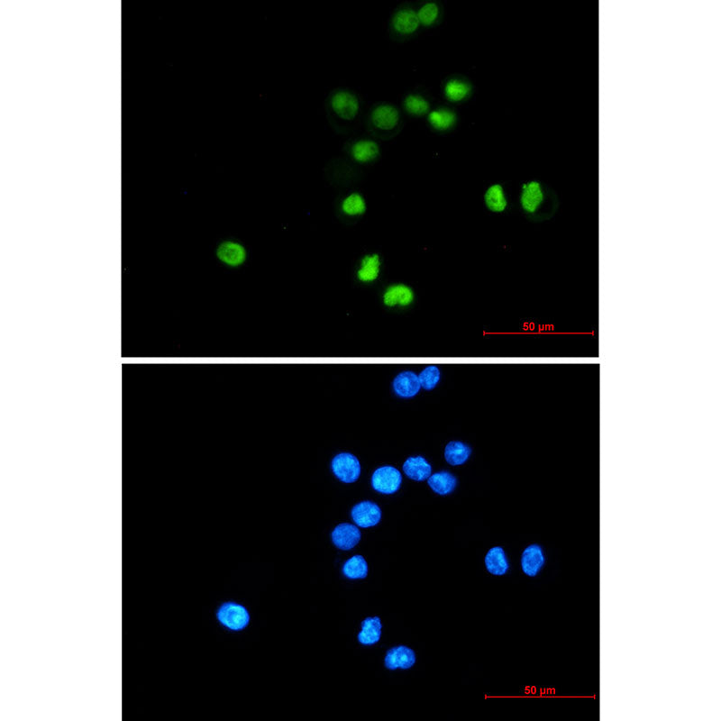 Anti-p53 Rabbit Monoclonal Antibody