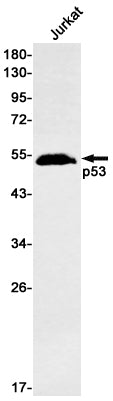 Anti-p53 Rabbit Monoclonal Antibody
