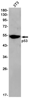 Anti-p53 Rabbit Monoclonal Antibody