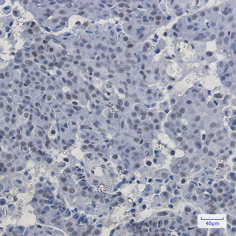 Anti-PABPN1 Rabbit Monoclonal Antibody