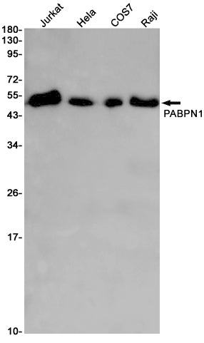 Anti-PABPN1 Rabbit Monoclonal Antibody