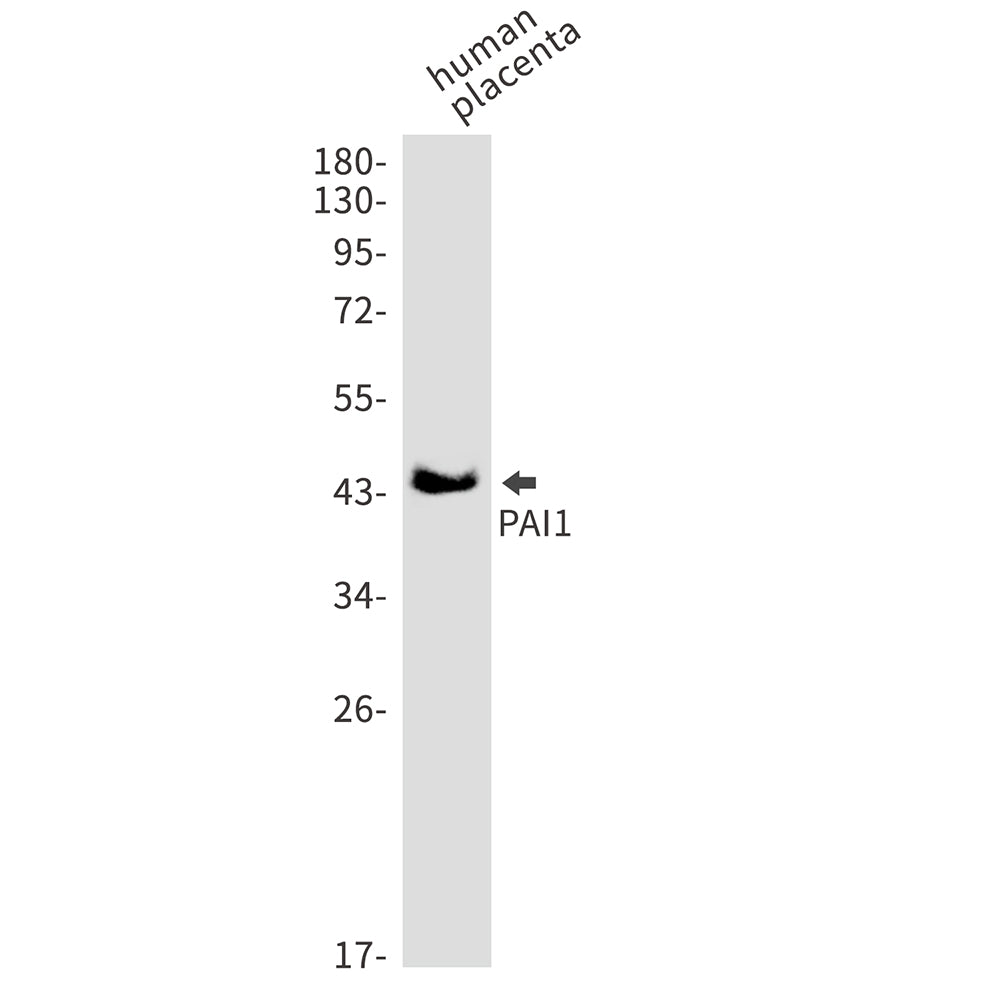 Anti-PAI1 Rabbit Monoclonal Antibody