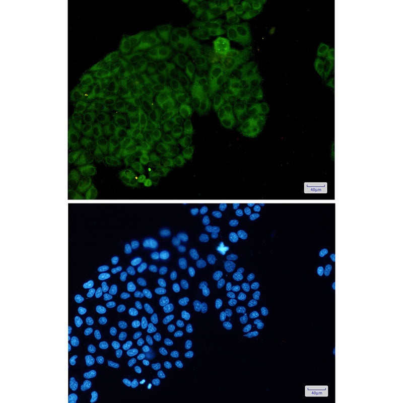 Anti-Phospho-PAK1/2/3 (Ser144/Ser141/Ser154) Rabbit Monoclonal Antibody