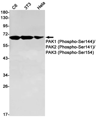 Anti-Phospho-PAK1/2/3 (Ser144/Ser141/Ser154) Rabbit Monoclonal Antibody