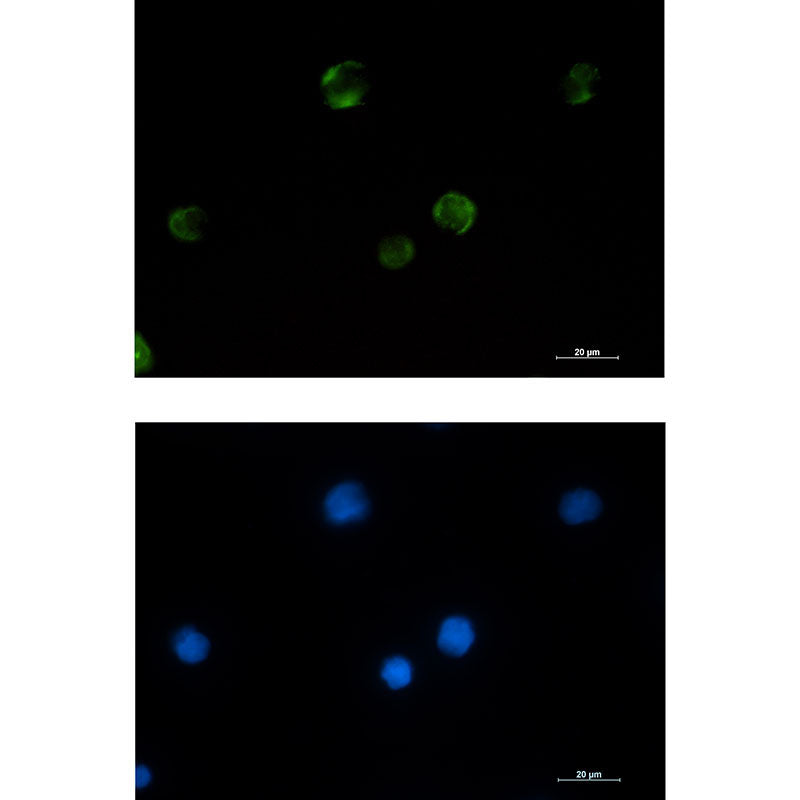 Anti-PAK1 Rabbit Monoclonal Antibody