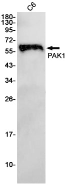 Anti-PAK1 Rabbit Monoclonal Antibody