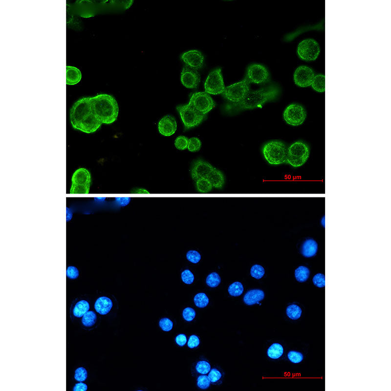 Anti-P cadherin Rabbit Monoclonal Antibody