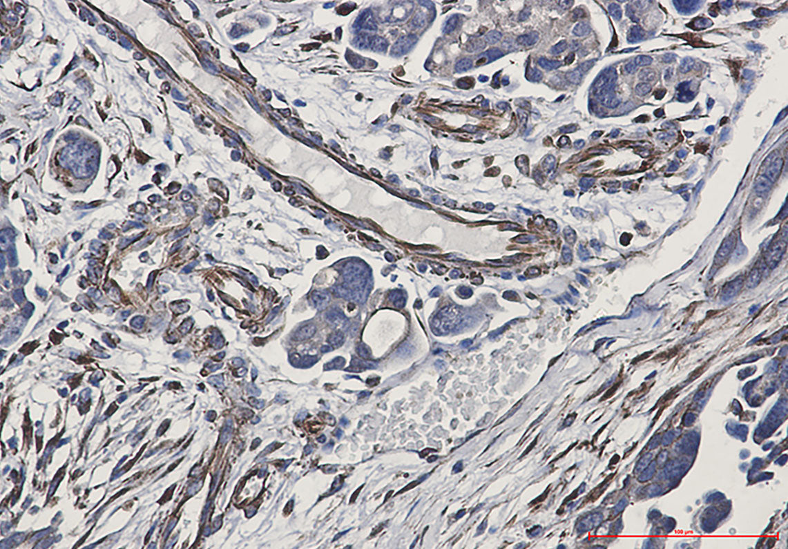 Anti-P cadherin Rabbit Monoclonal Antibody