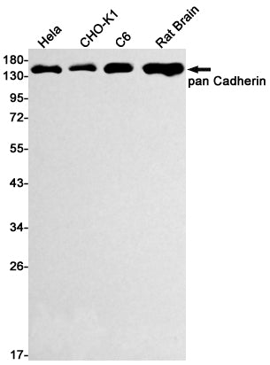 Anti-P cadherin Rabbit Monoclonal Antibody