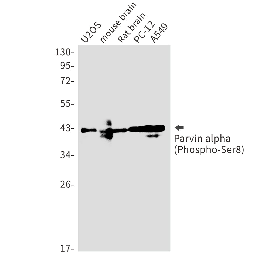 Anti-Phospho-Parvin alpha (Ser8) Rabbit Monoclonal Antibody