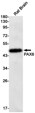 Anti-PAX6 Rabbit Monoclonal Antibody