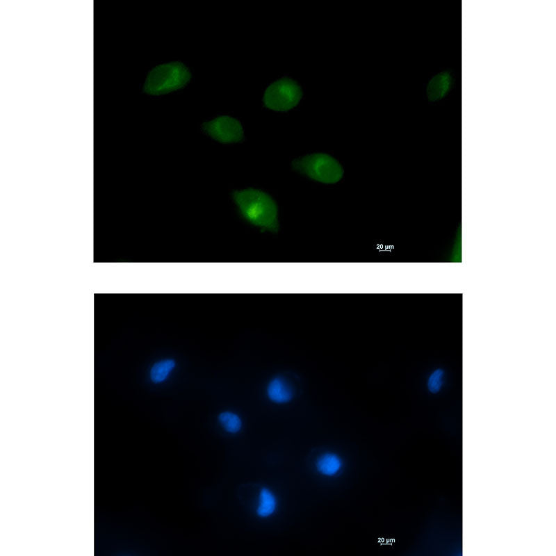 Anti-PCK2 Rabbit Monoclonal Antibody
