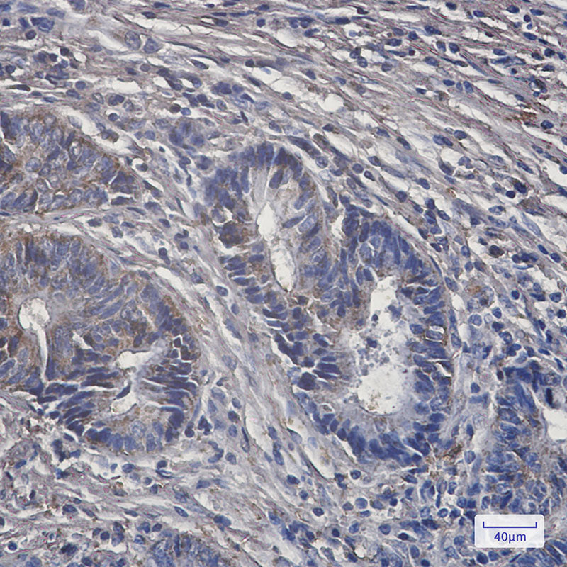Anti-PCK2 Rabbit Monoclonal Antibody