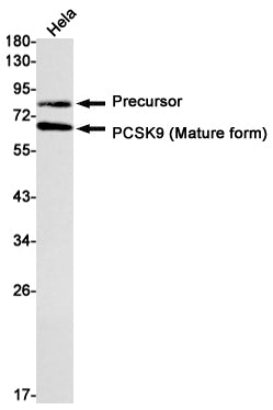 Anti-PCSK9 Rabbit Monoclonal Antibody