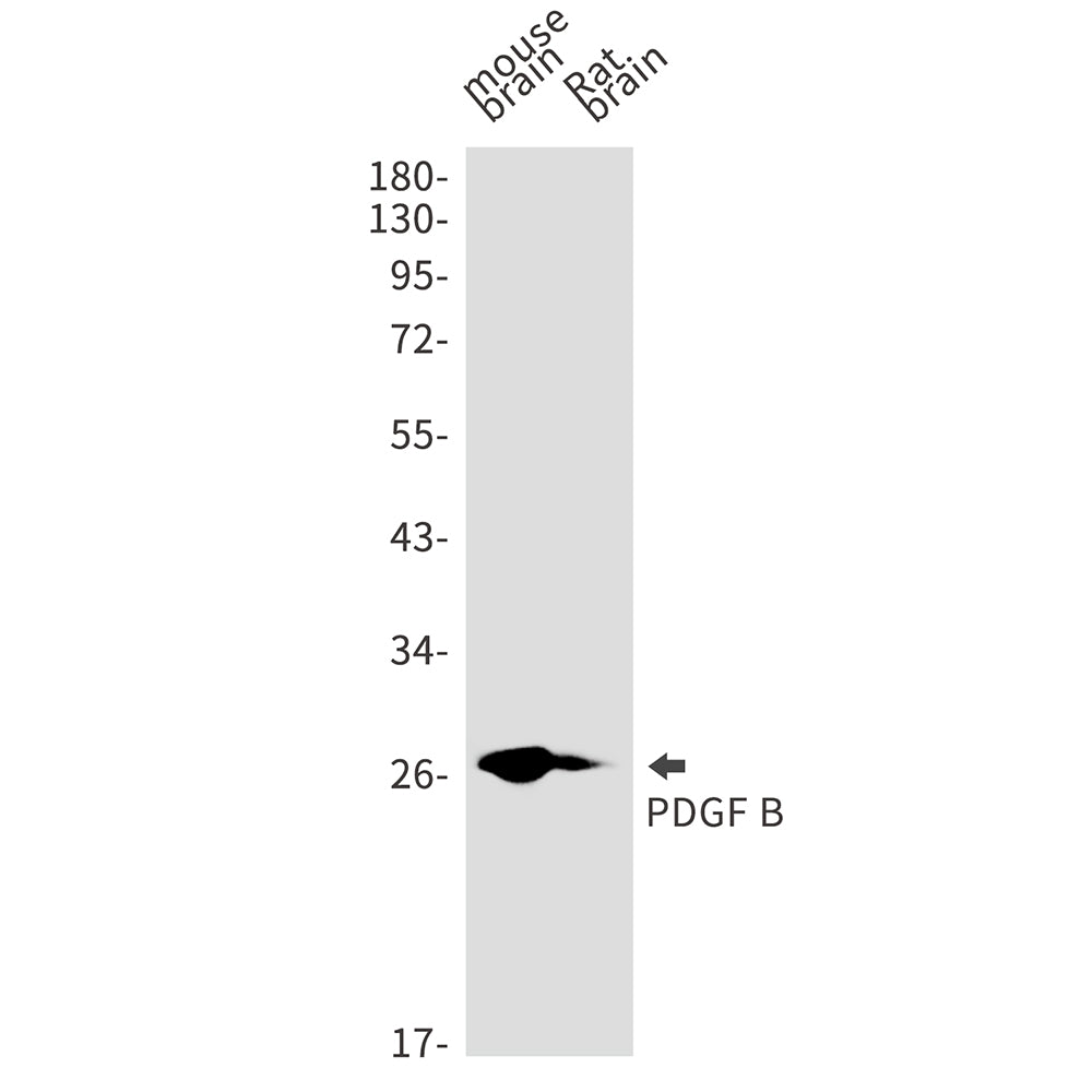 Anti-PDGF B Rabbit Monoclonal Antibody