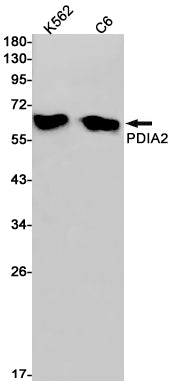 Anti-P4HB Rabbit Monoclonal Antibody