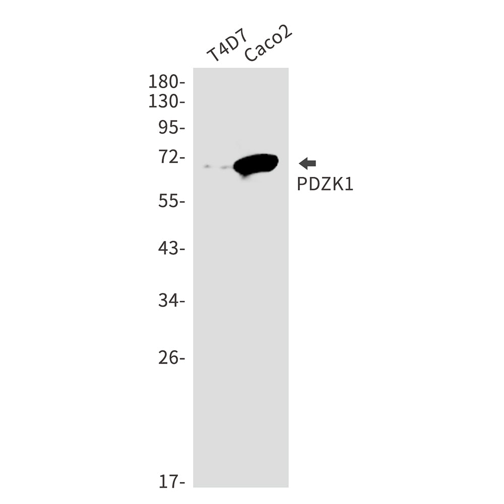 Anti-PDZK1 Rabbit Monoclonal Antibody