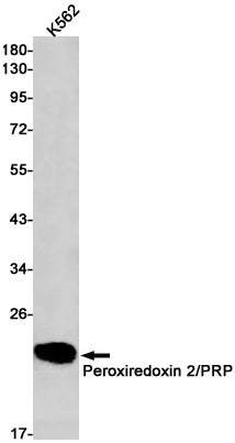 Anti-Peroxiredoxin 2 Rabbit Monoclonal Antibody