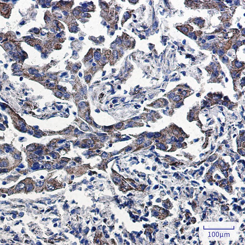 Anti-Peroxiredoxin 5 Rabbit Monoclonal Antibody