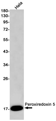 Anti-Peroxiredoxin 5 Rabbit Monoclonal Antibody