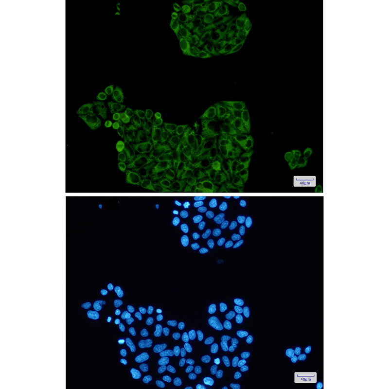 Anti-PFKP Rabbit Monoclonal Antibody