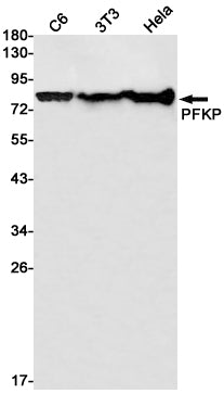Anti-PFKP Rabbit Monoclonal Antibody