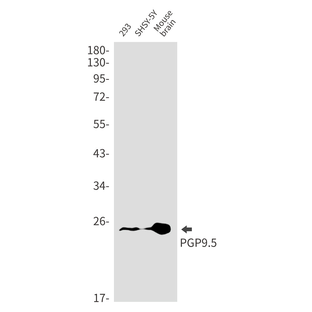 Anti-PGP9.5 Rabbit Monoclonal Antibody