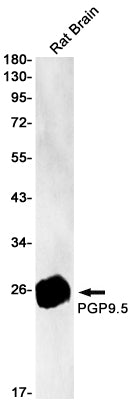 Anti-PGP9.5 Rabbit Monoclonal Antibody