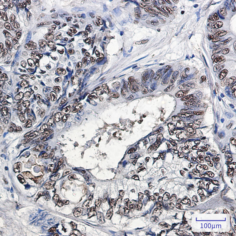 Anti-PHAPI2 Rabbit Monoclonal Antibody