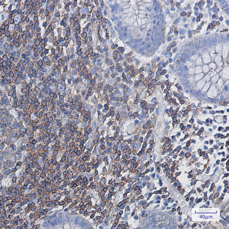 Anti-PHD3 Rabbit Monoclonal Antibody