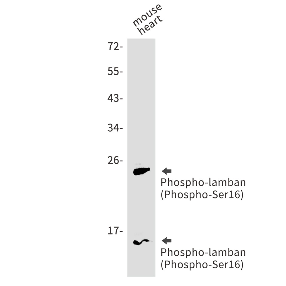 Anti-Phospho-Phospholamban (Ser16) Rabbit Monoclonal Antibody
