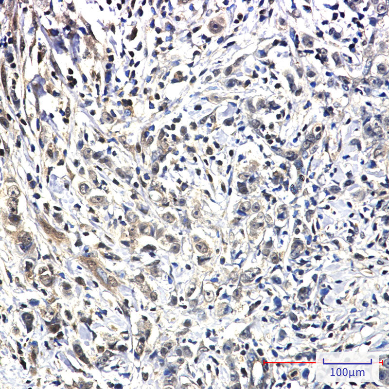 Anti-PIN1 Rabbit Monoclonal Antibody