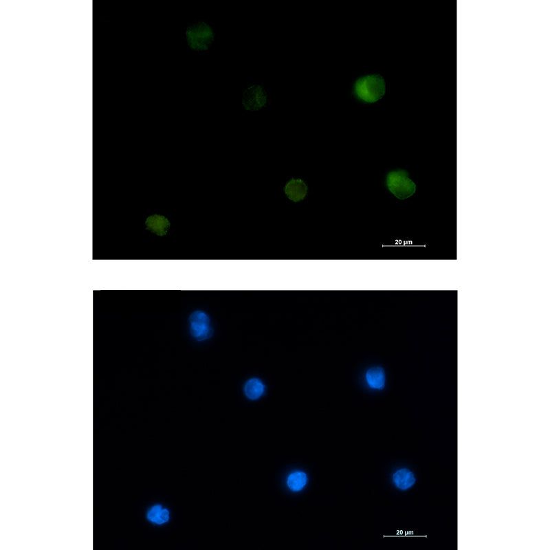 Anti-PKC beta 2 Rabbit Monoclonal Antibody
