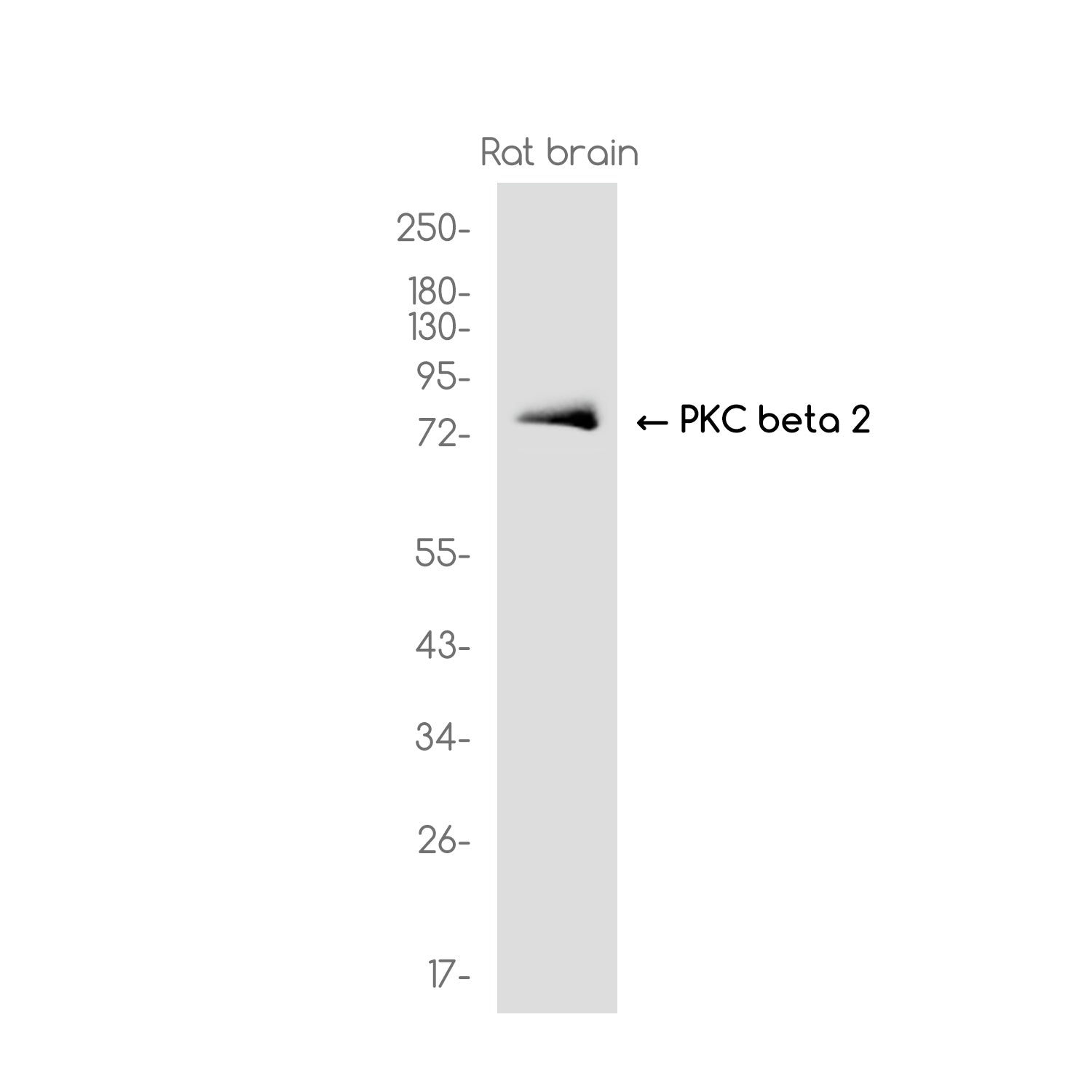 Anti-PKC beta 2 Rabbit Monoclonal Antibody