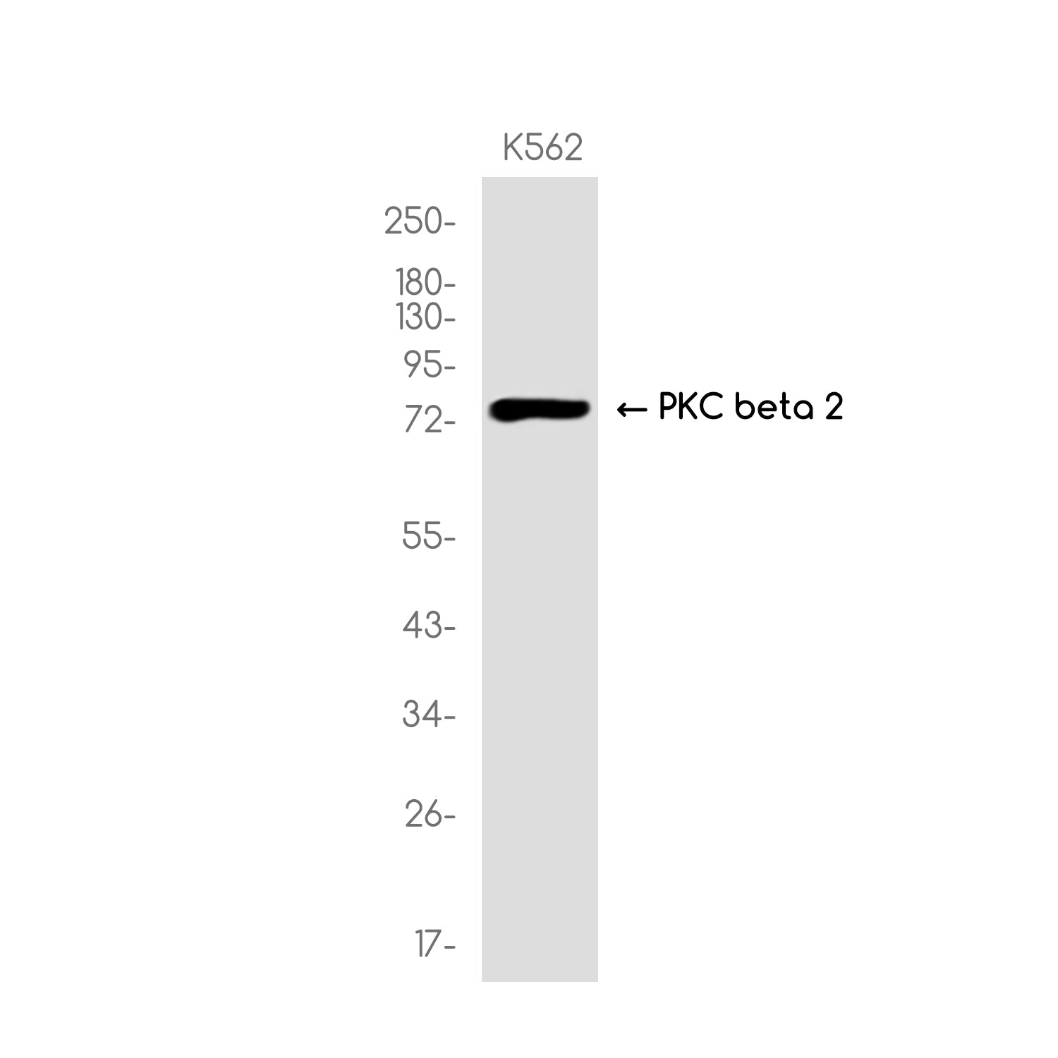 Anti-PKC beta 2 Rabbit Monoclonal Antibody