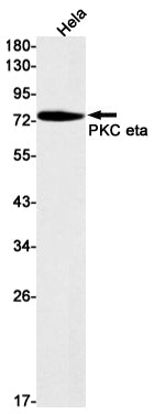 Anti-PKC eta Rabbit Monoclonal Antibody