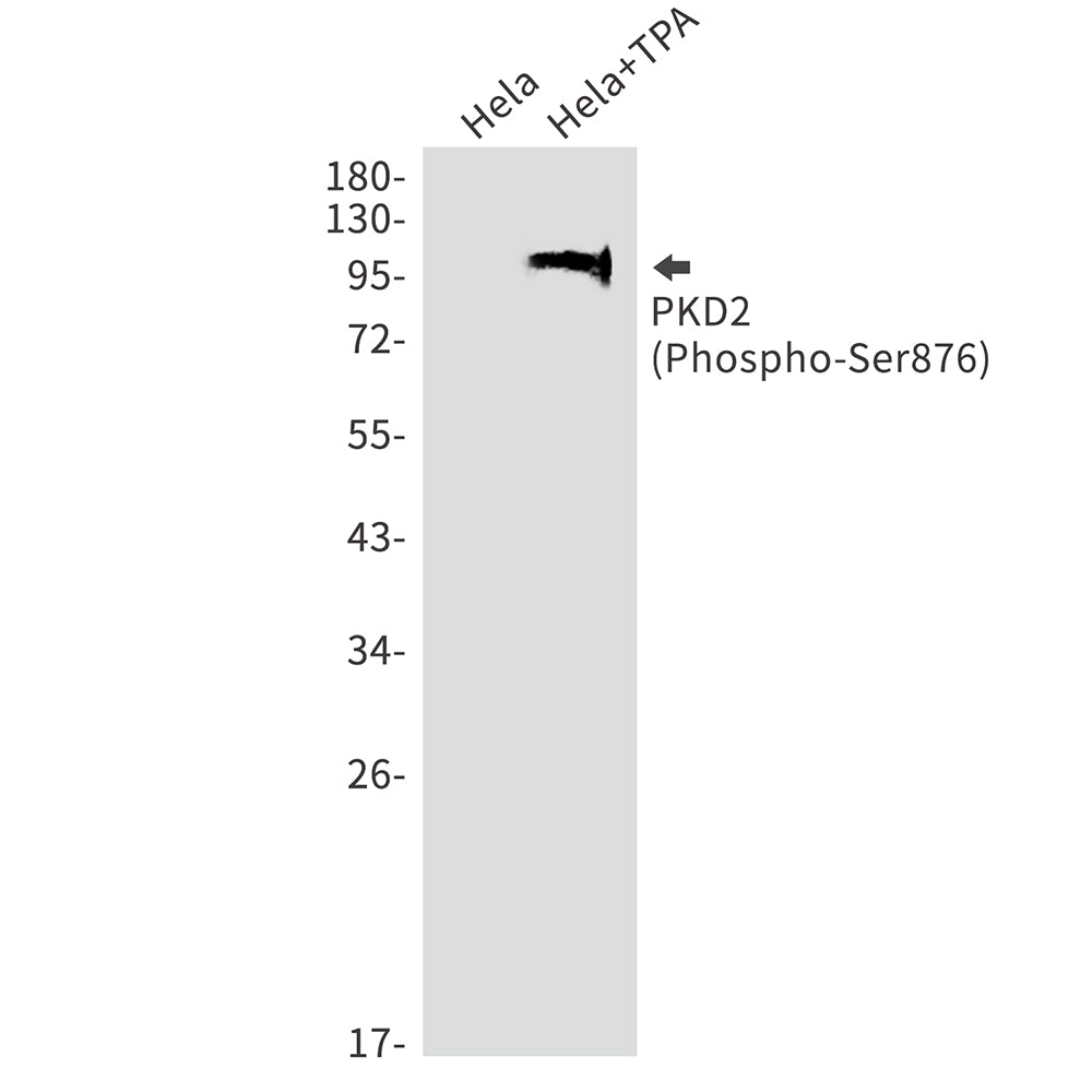 Anti-Phospho-PRKD2 (Ser876) Rabbit Monoclonal Antibody